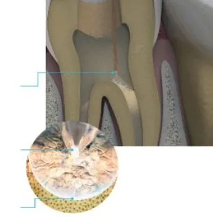 Illustrated closeup of a tooth